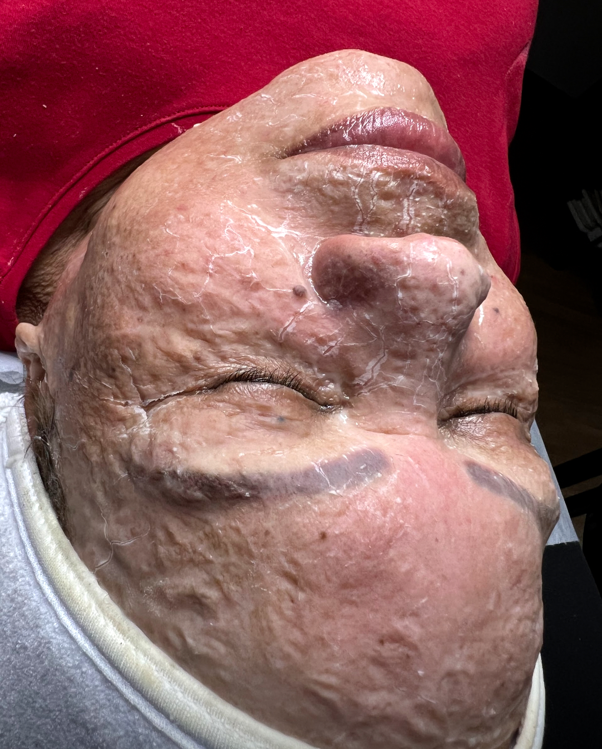 Anti Aging Facial