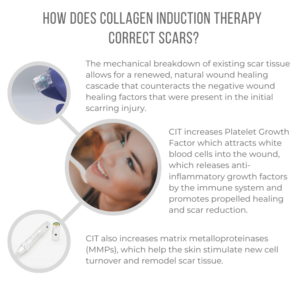 Microneedling spot  treatment