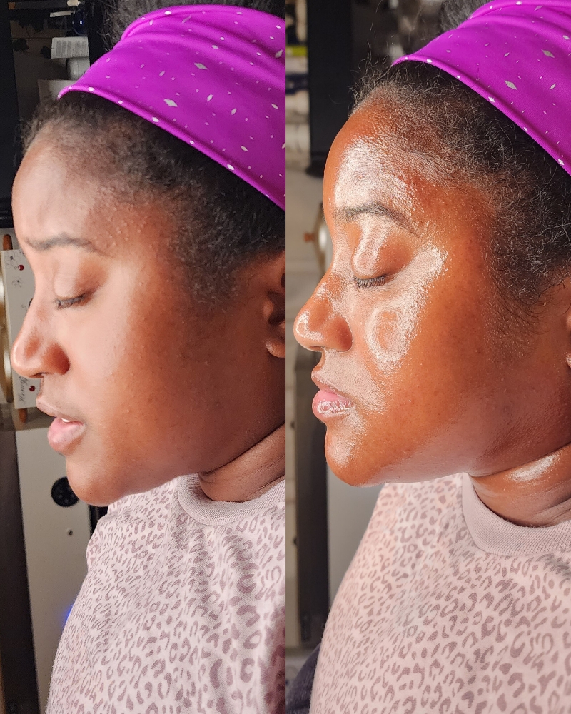 Forever Glow Treatment