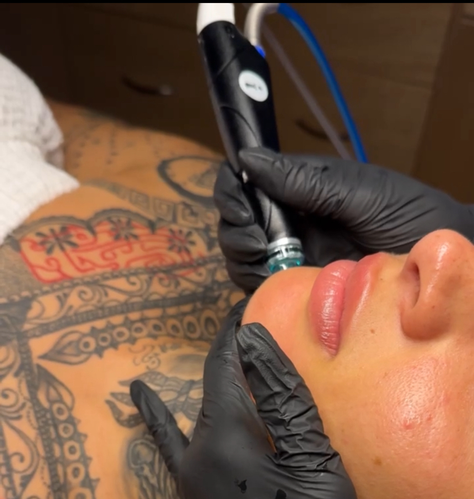 Deluxe Hydrafacial