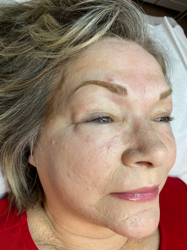 Microblading