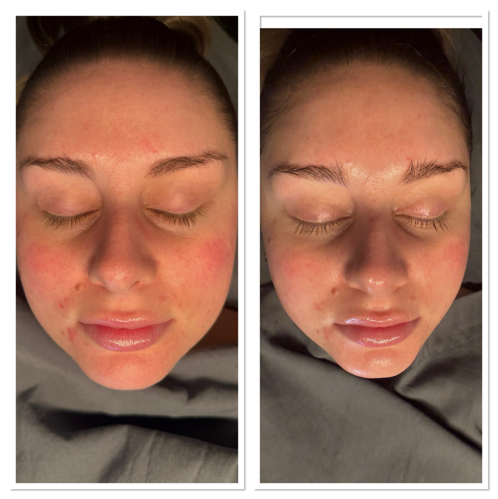 Bloom Brightening Facial at GlowHaus Collective By Monét in Camden, AR