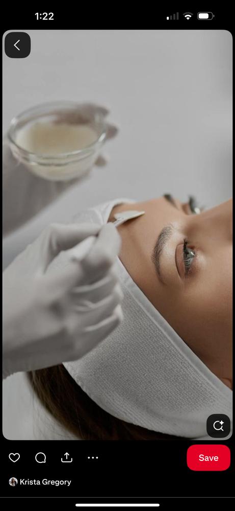 Chemical peel