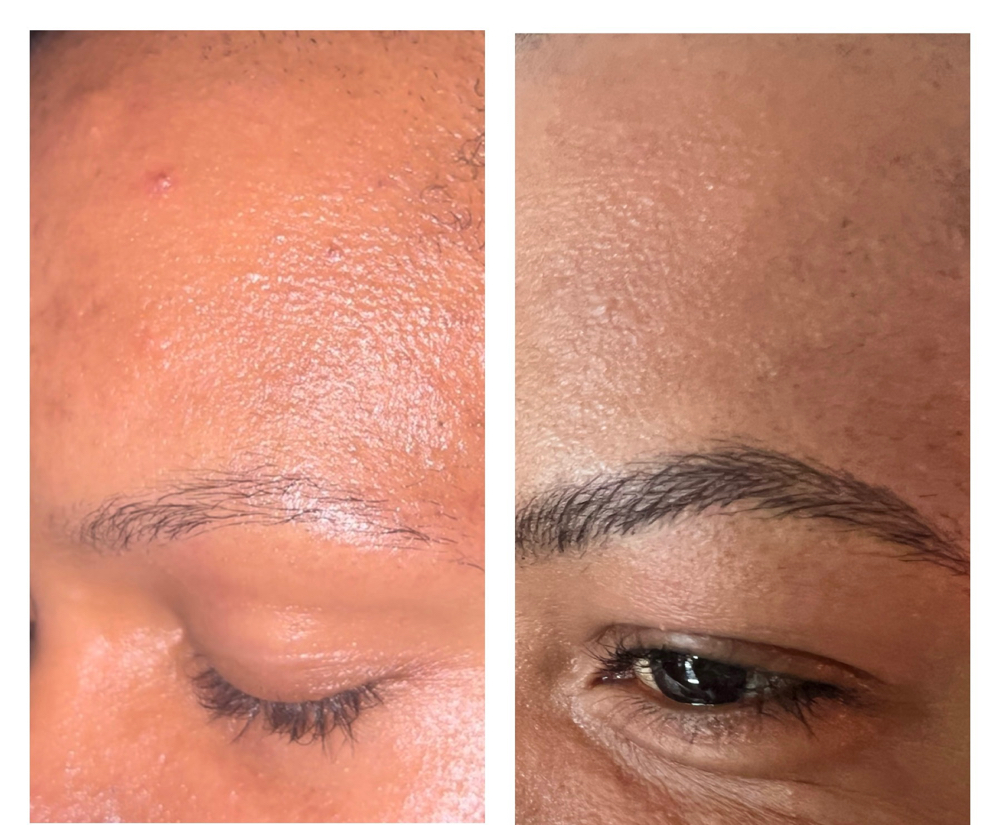 Microblading