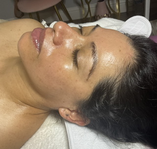 Microdermabrasion