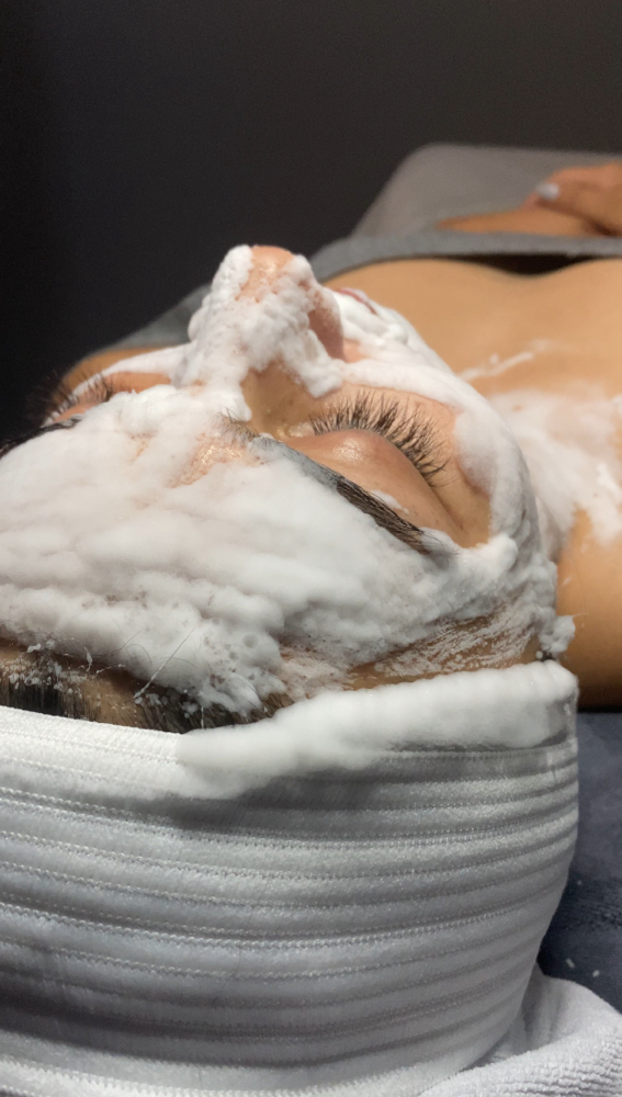 Detailed Acne Treatment