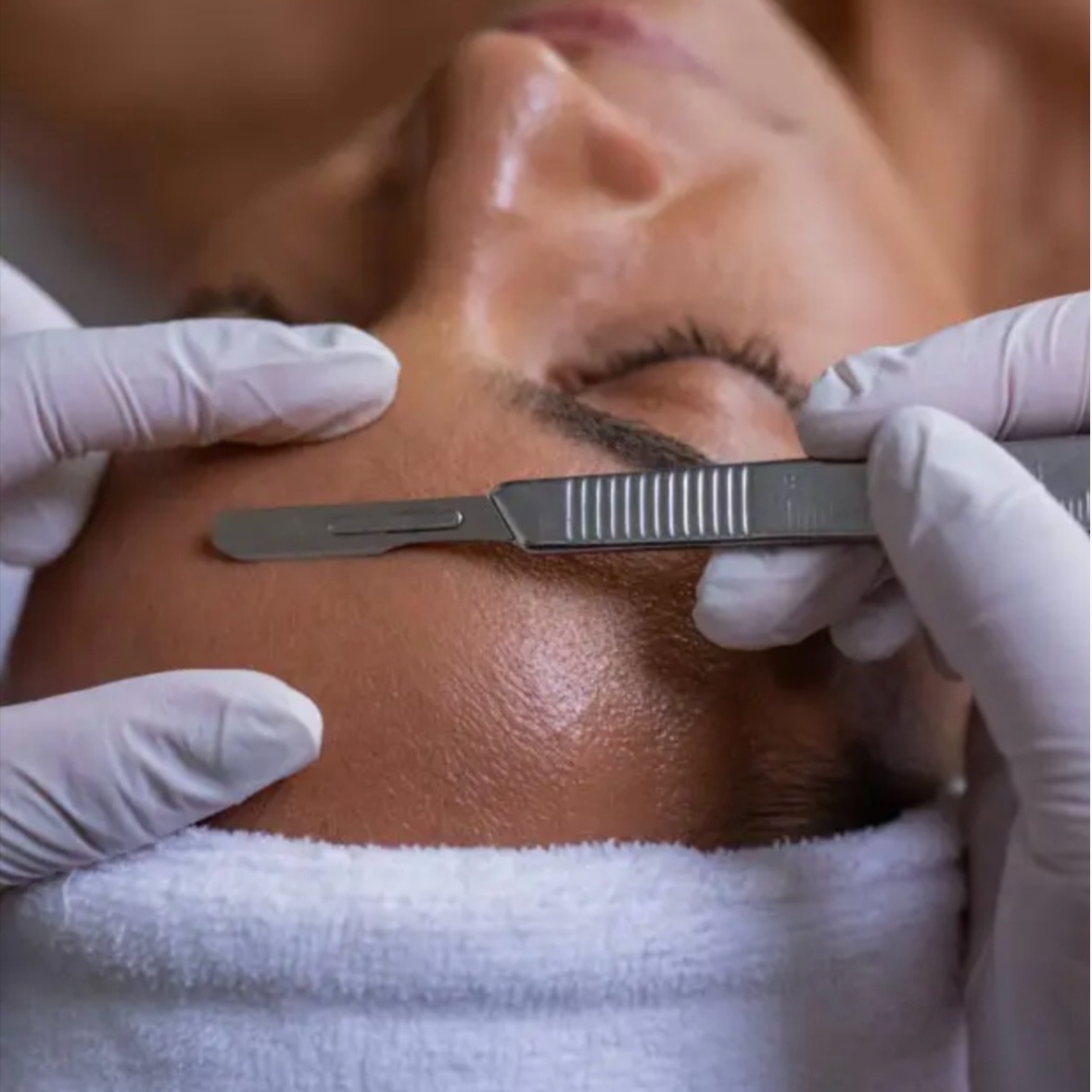Dermaplane - Add On at Abide Salon in Chattanooga, TN