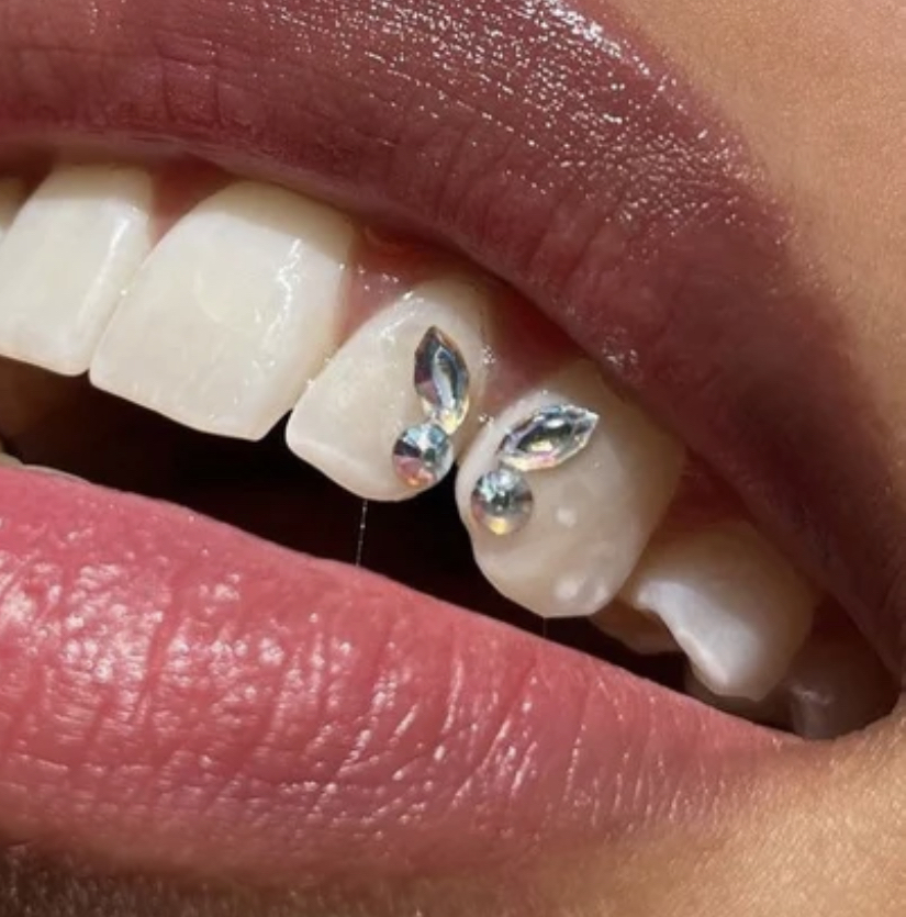 Butterfly Tooth Gem Set