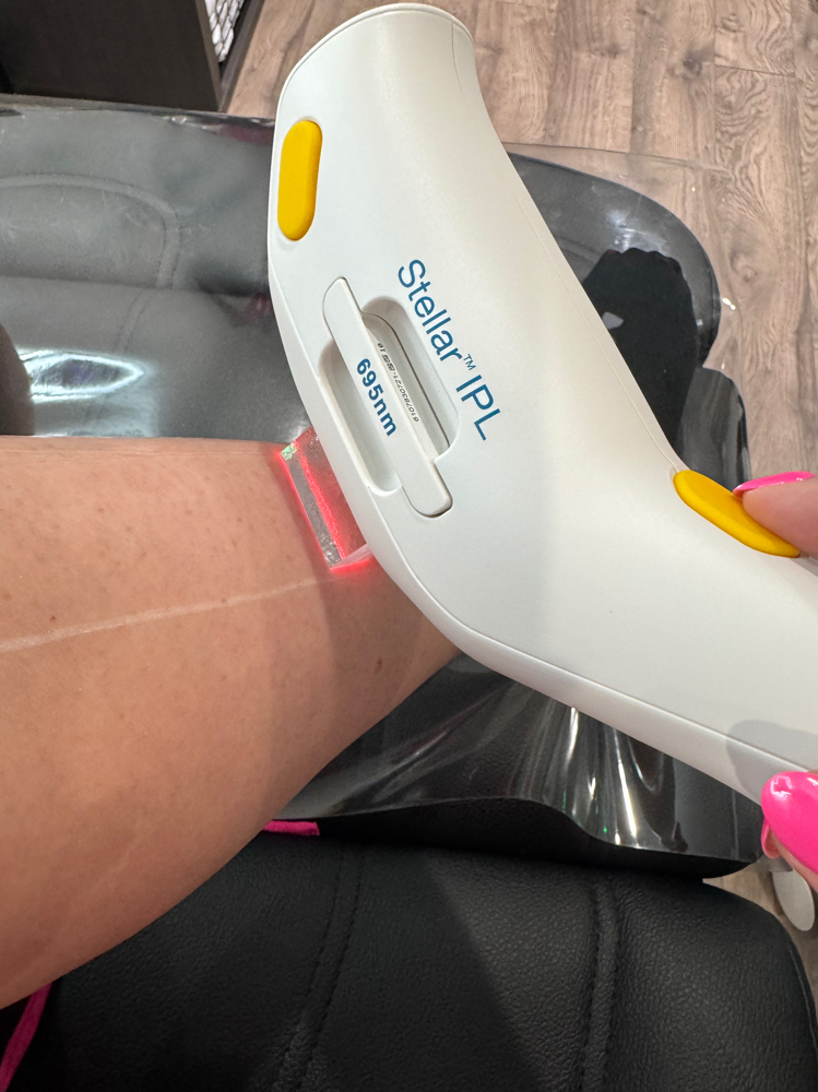 Laser Hair Removal IPL