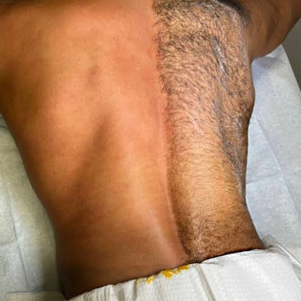 Back Waxing at U-Turn Salon in Palmyra, PA