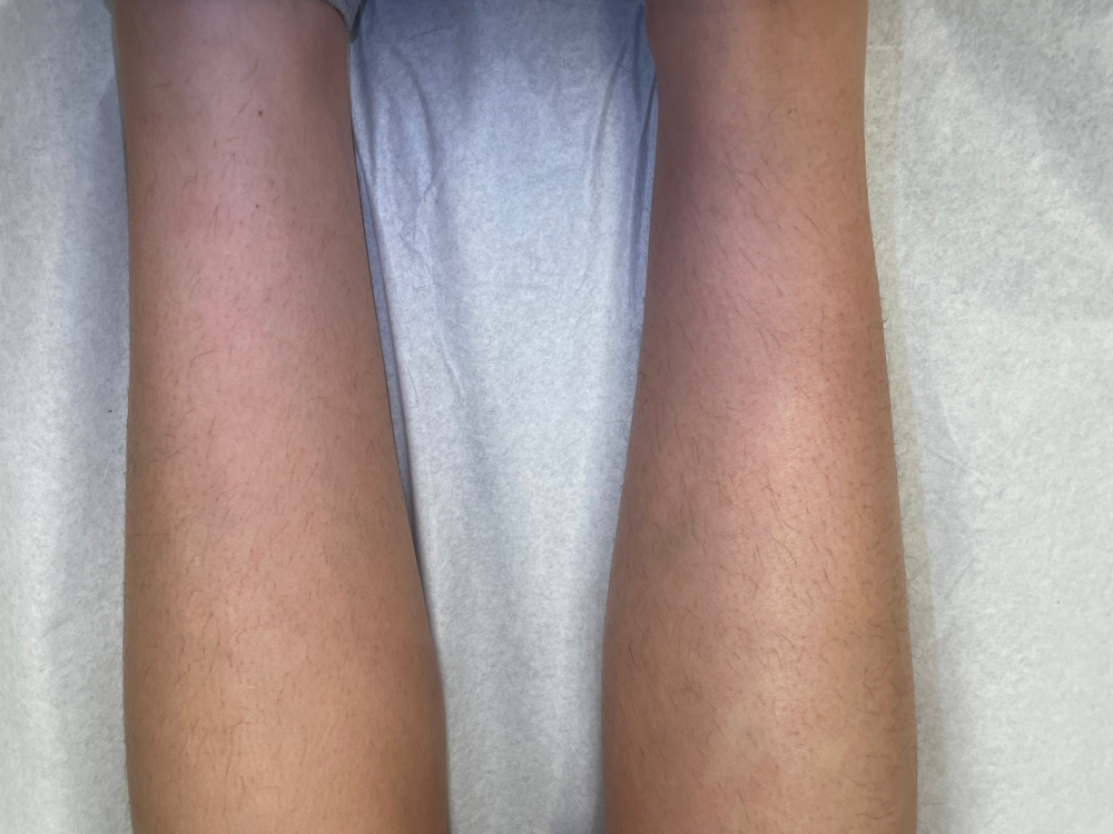 Arm Wax