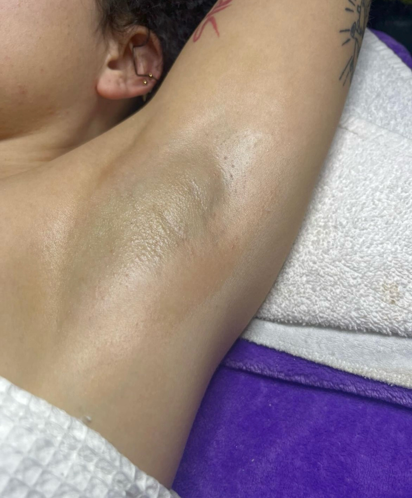 Underarms