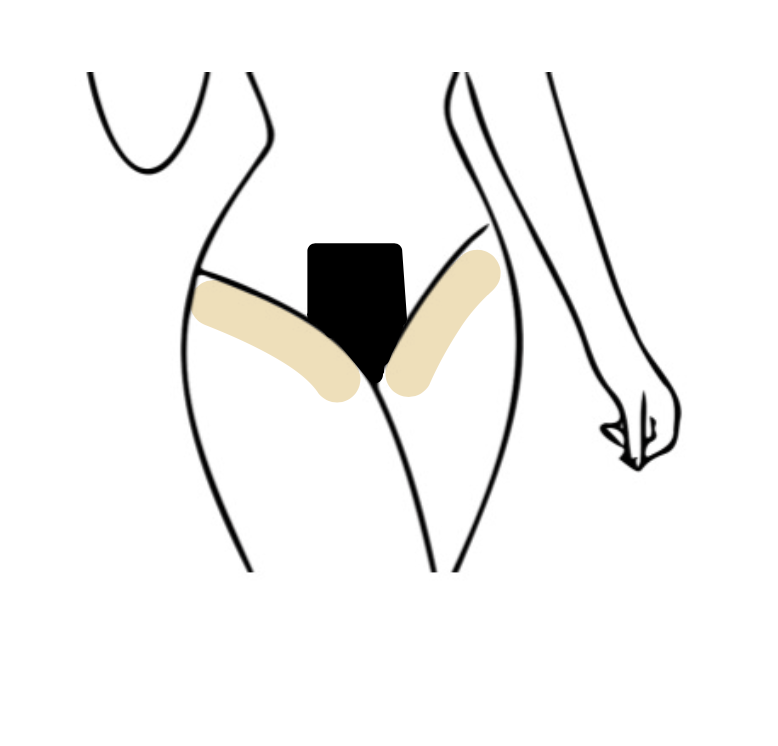 French Bikini Wax