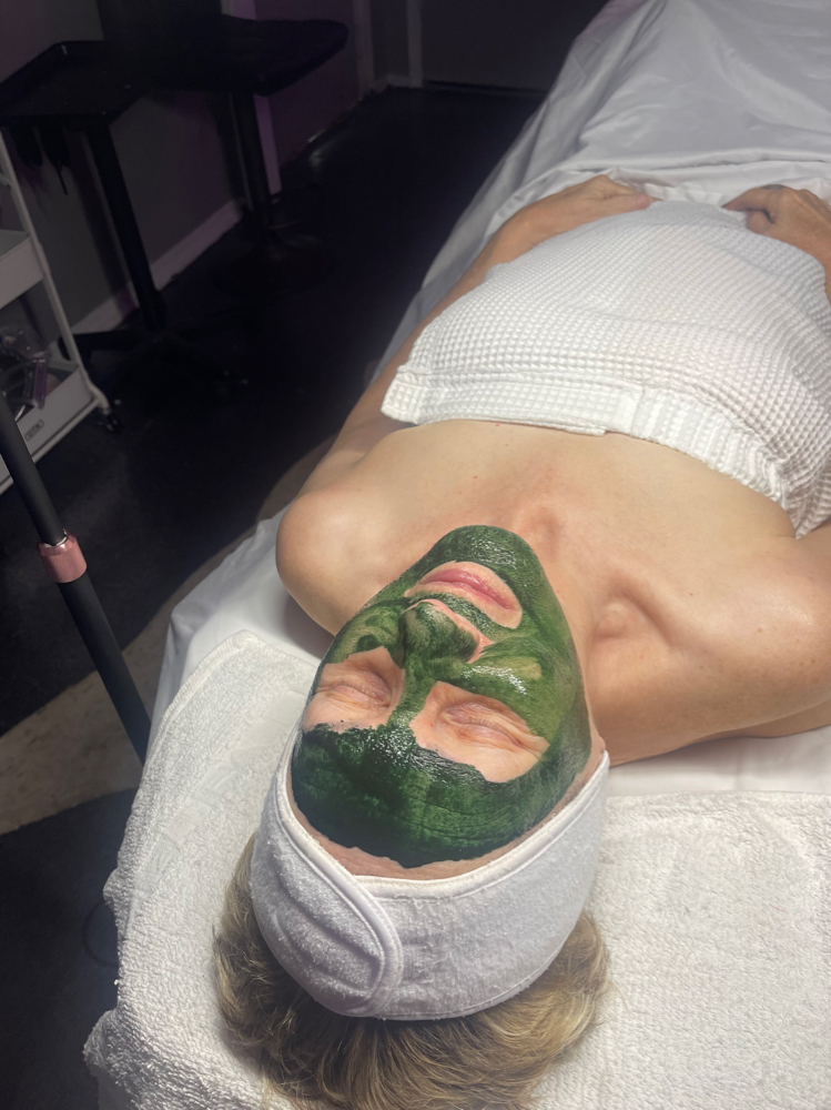 Chemical Peel