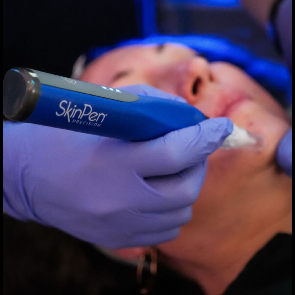 Hydraneedling Combo Treatment