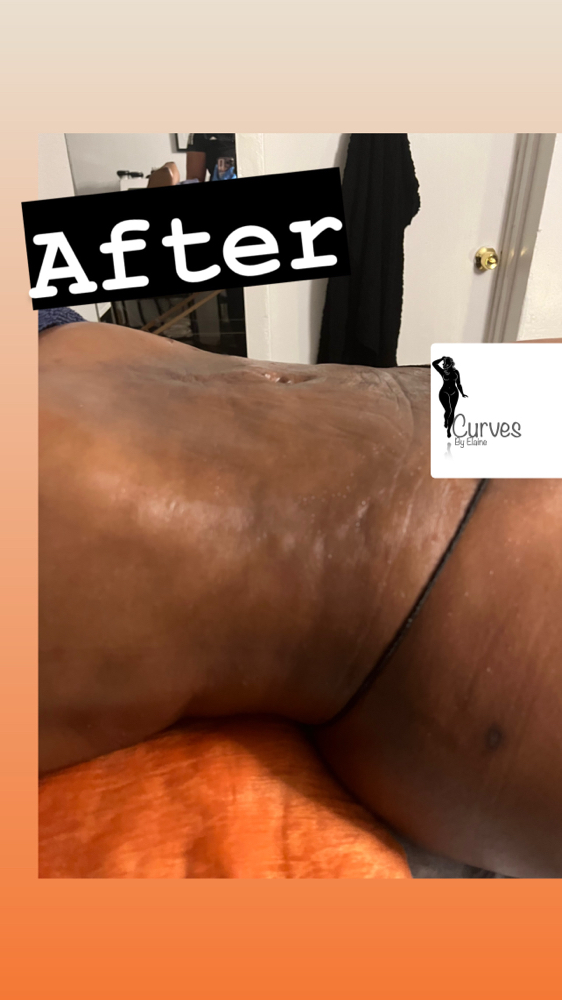 Lymphatic Drainage Massage