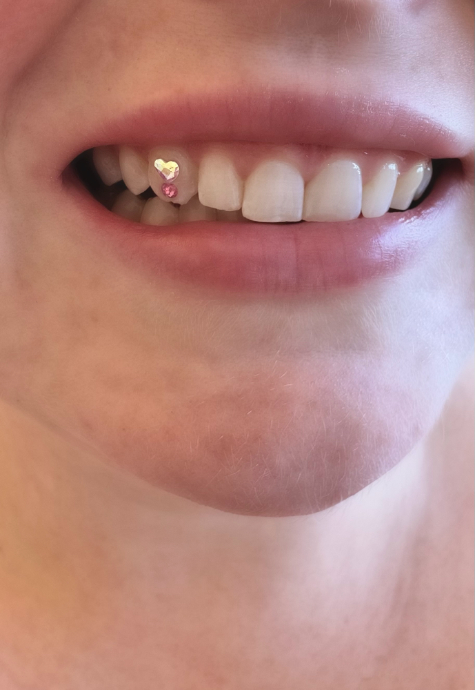 Tooth Gem