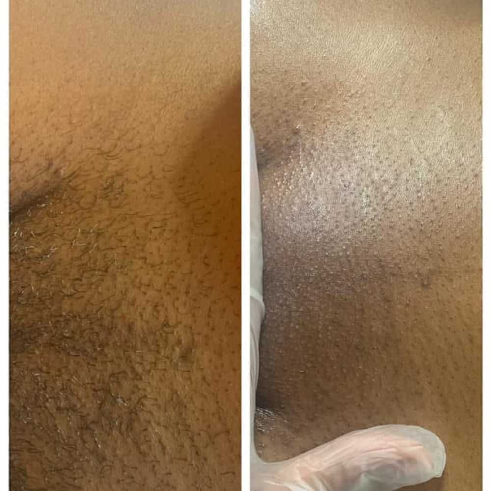 Brazilian Maintance at Your Local Coochie Waxer in Louisville, KY