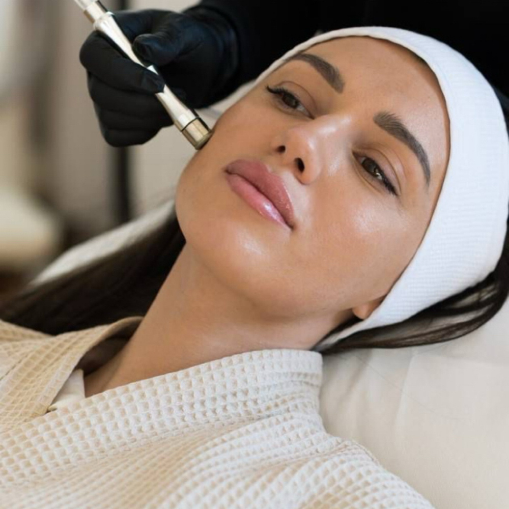 Microdermabrasion at Aurèa Skin Atelier in Greeley, CO