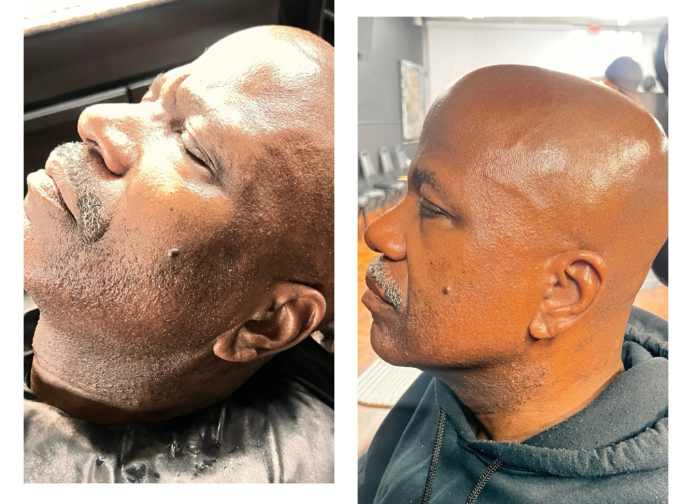 Gentleman’s Bald Head Facial