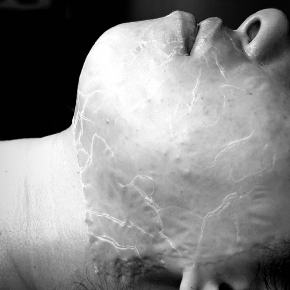 FACE REALITY ACNE FACIAL at THE AESTHETIC LABS in Taylor, MI
