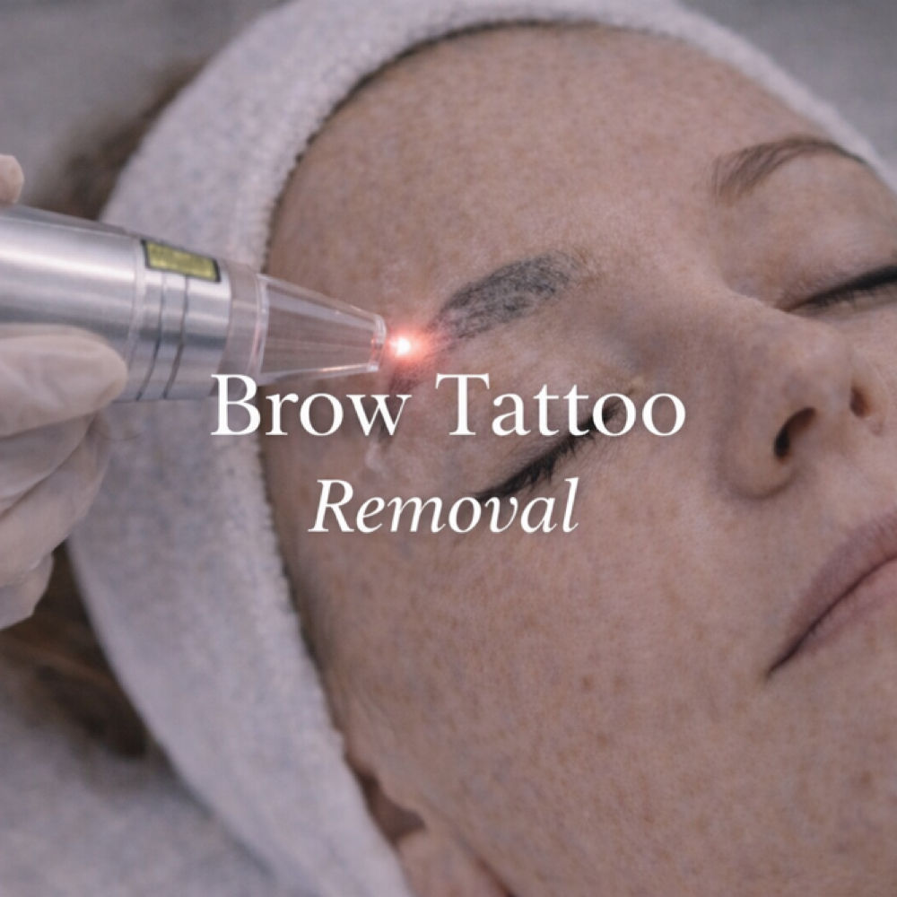 🌟BROW TATTOO REMOVAL CONSULTATION
