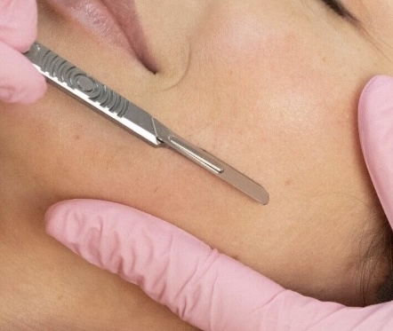 Dermaplane Add On