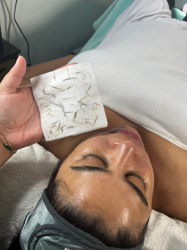 You Glow Girl! (DERMAPLANE FACIAL) at Ethereal Skin x Jenn in Bloomfield, NJ