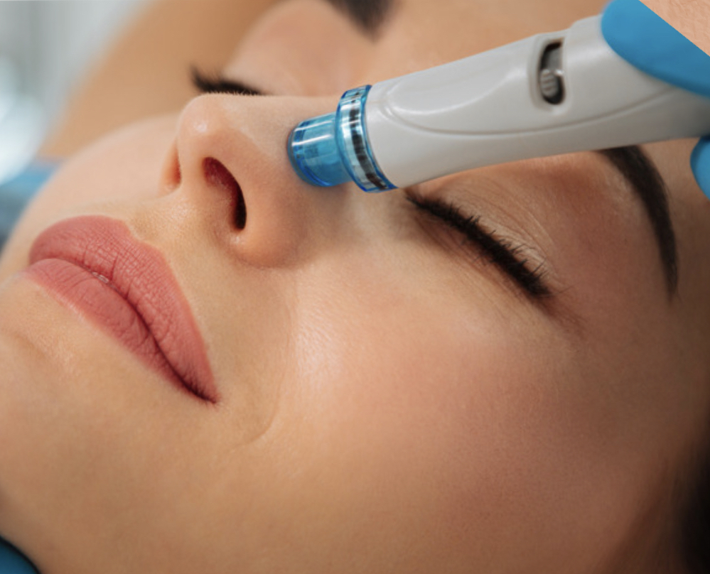 Hydrodermabrasion