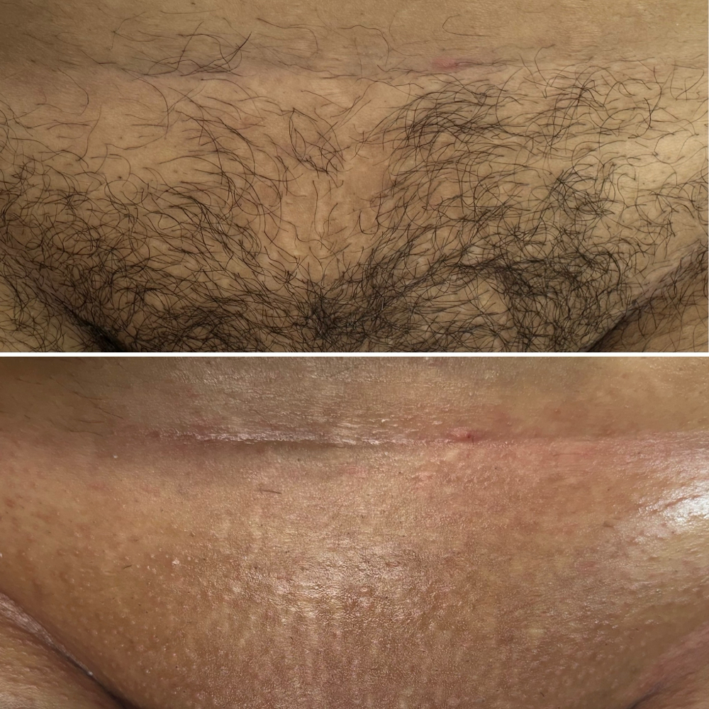 Brazilian Wax (females Only) at LeiBeauty Loft in Wenatchee, WA
