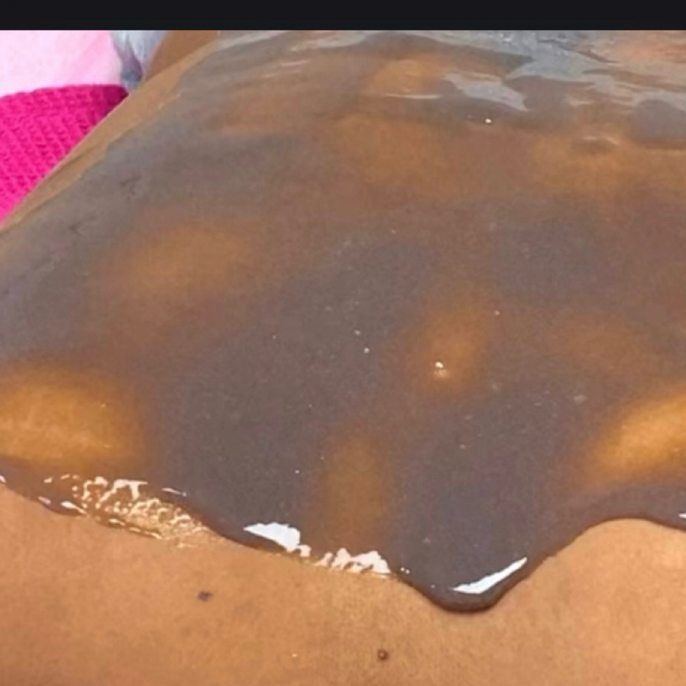 Back Treatment at Sweet Dreams Spa in Bronx, NY