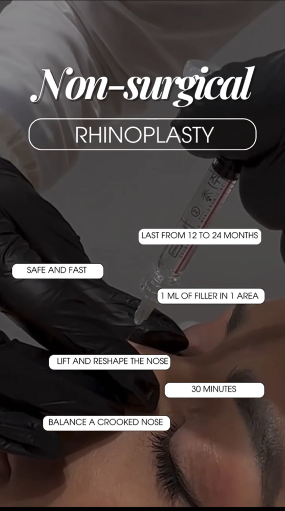 NON-SURGICAL RHINOPLASTY