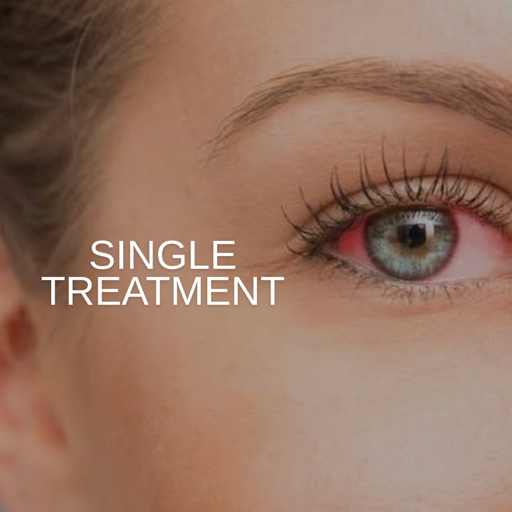 Dry Eye Treatment at PRYSM LIGHT in West Burlington, IA
