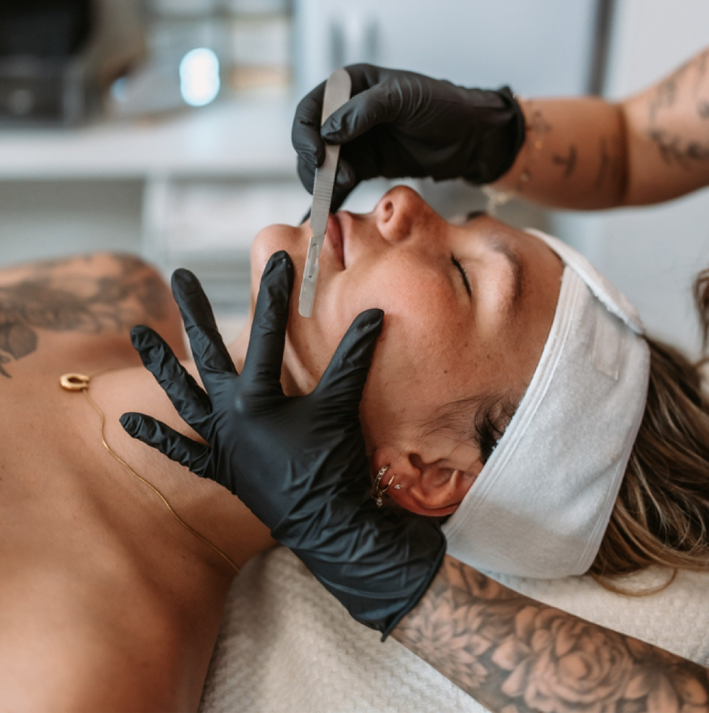 Dermaplanning at The Inked Mellen in Peabody, MA