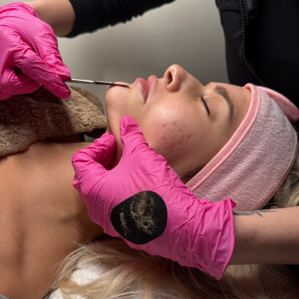 Glow And Go Dermaplane at Haleyskinbar in Weymouth, MA