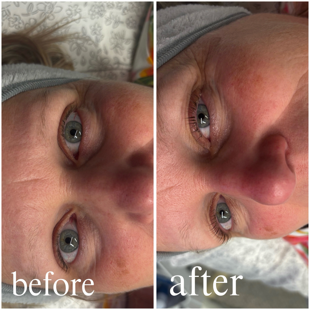 Lash Lift