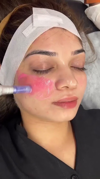 Cheek Blushing - Touch up