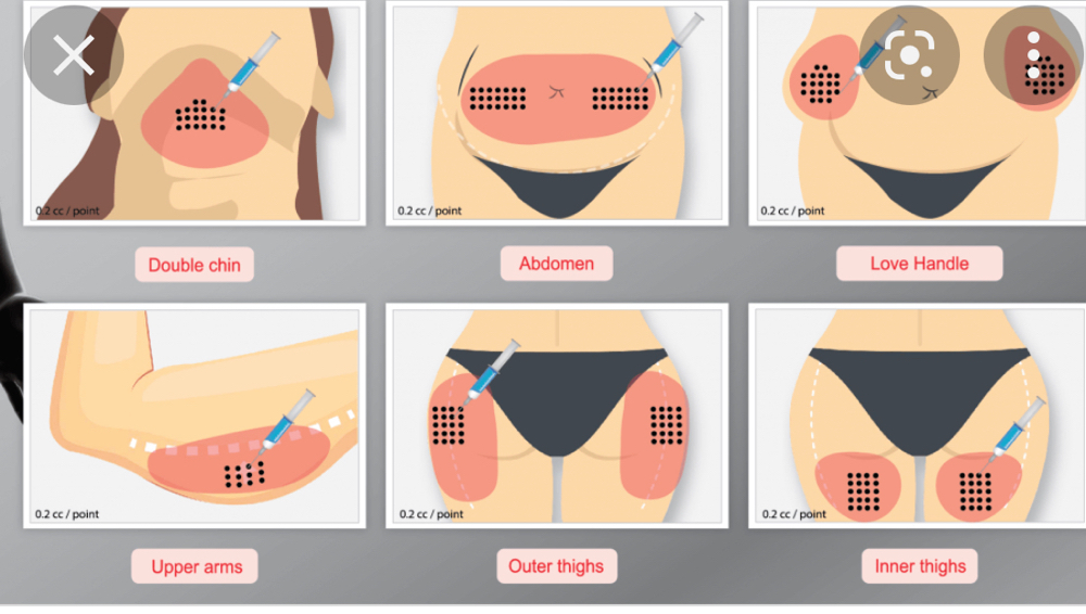 Fat Dissolving Treatment