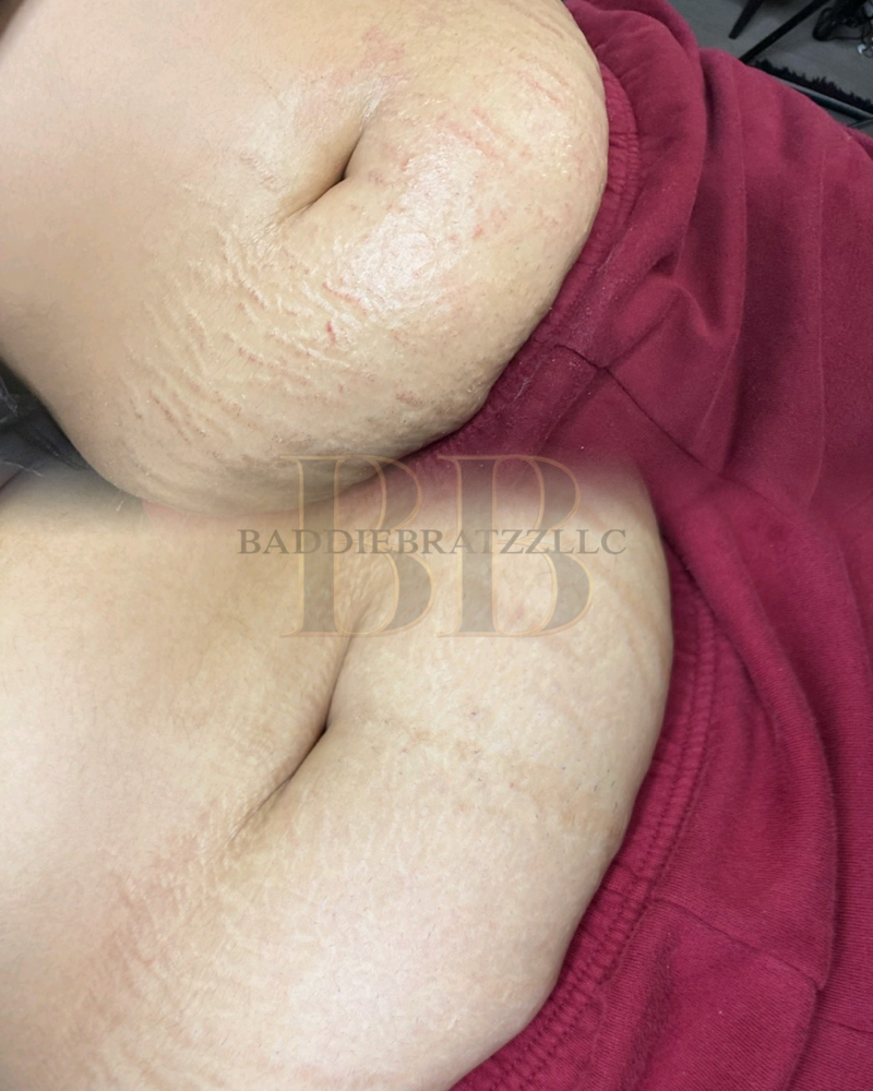 Stretch Mark Camouflage W Ink