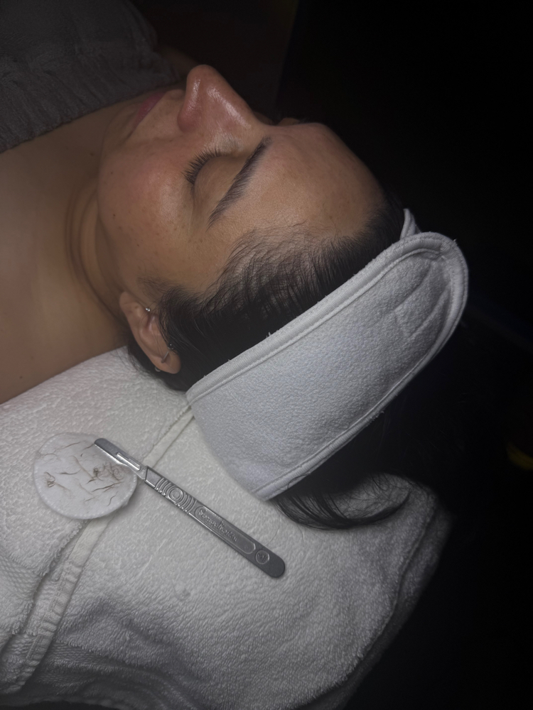 Dermaplaning at Skin Peace Beauty in Walnut Creek, CA