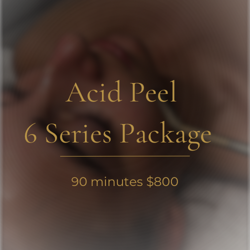 Acid Peel 6 Series Package🧪