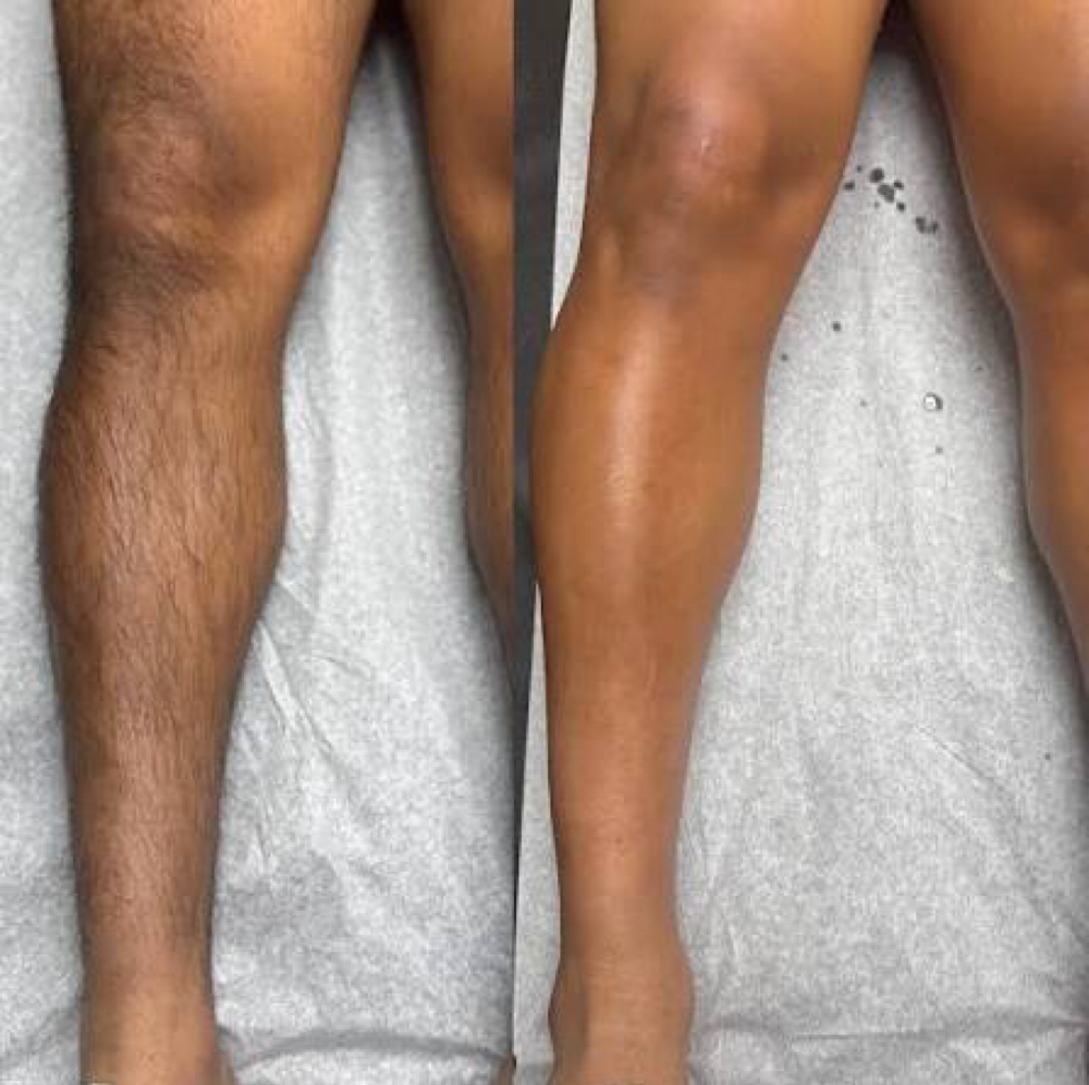 Full Leg Wax at Angelic Skin & Body in Oak Park, IL