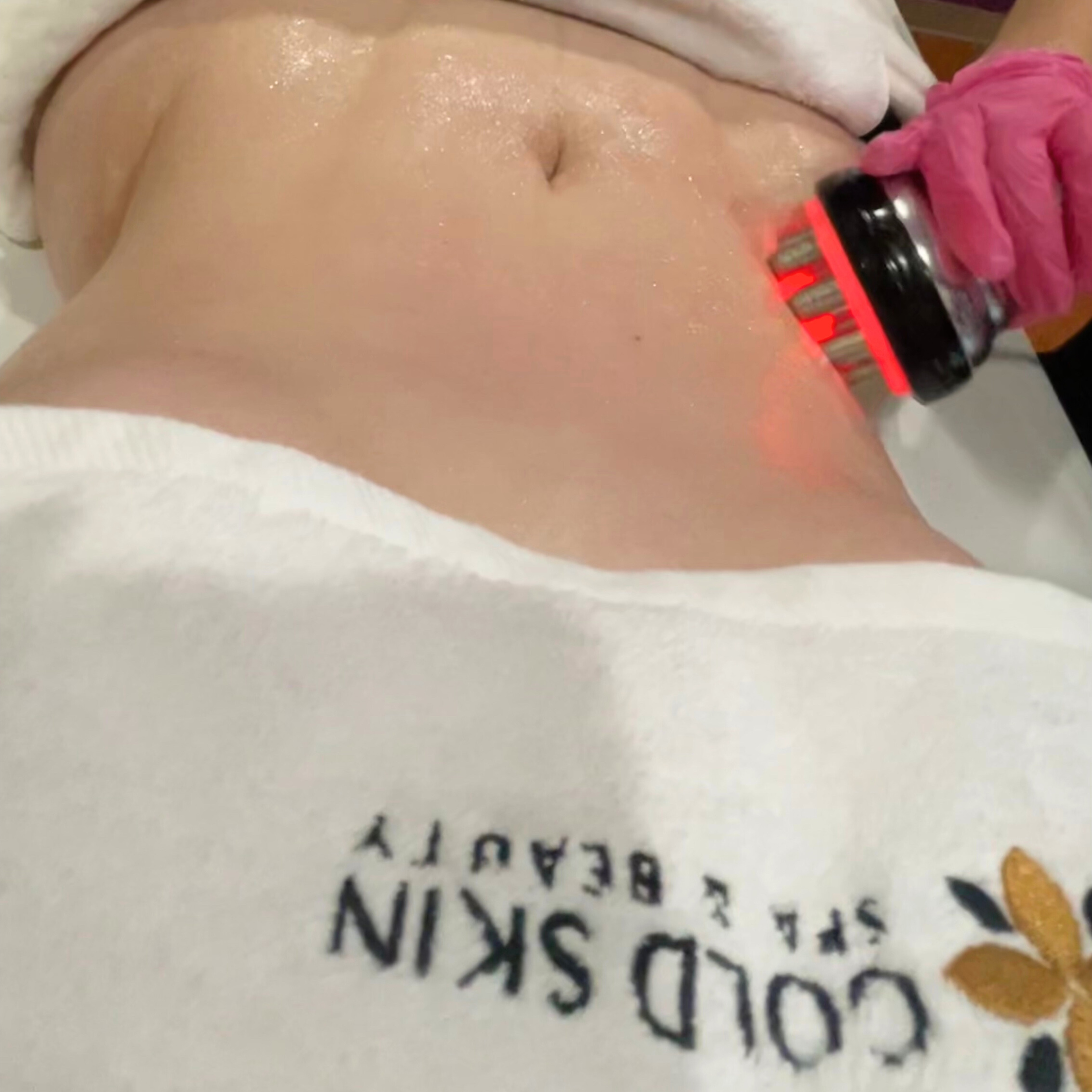 Body RF Tightening at GOLD SKIN SPA AND BEAUTY in MCALLENT, TX