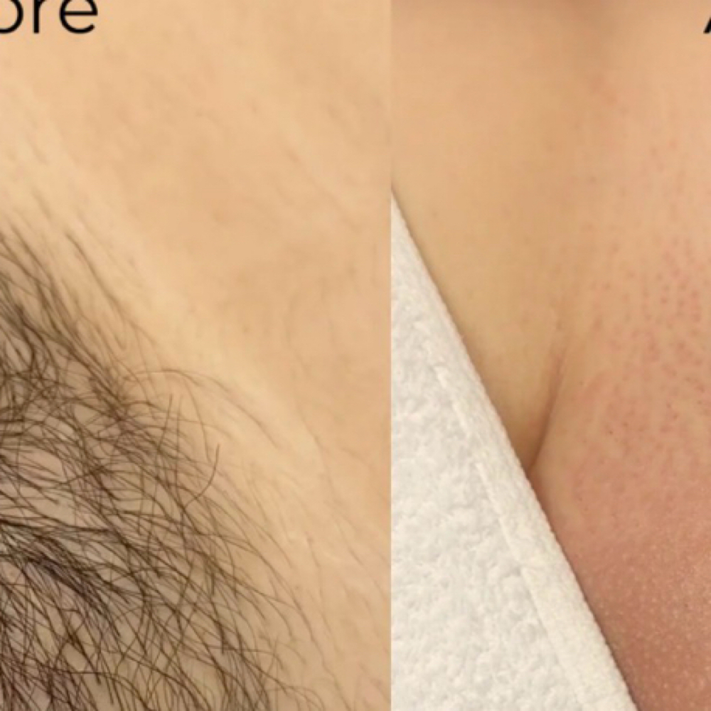 Brazilian Wax at Revive Beauty Co. in Fenton, MI