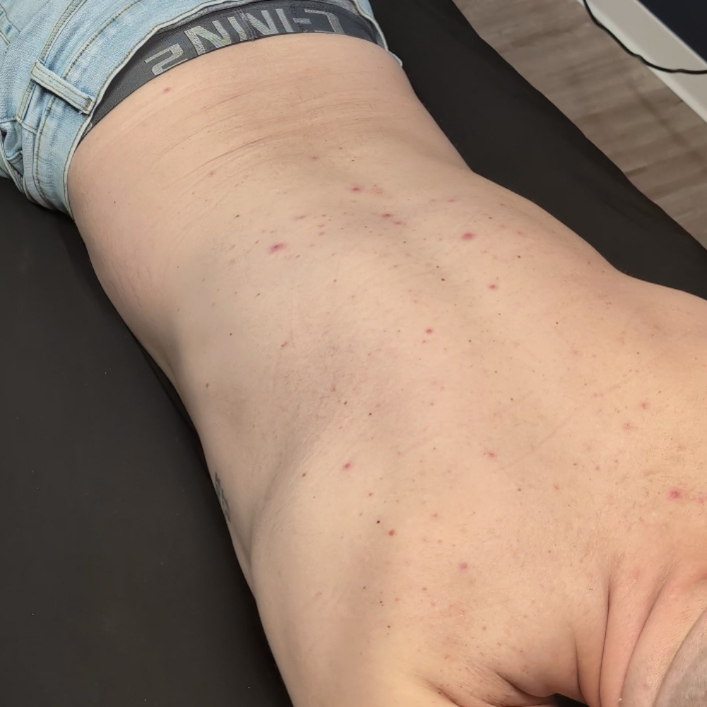 Back Wax at Moonlit Esthetics in Minneapolis, MN