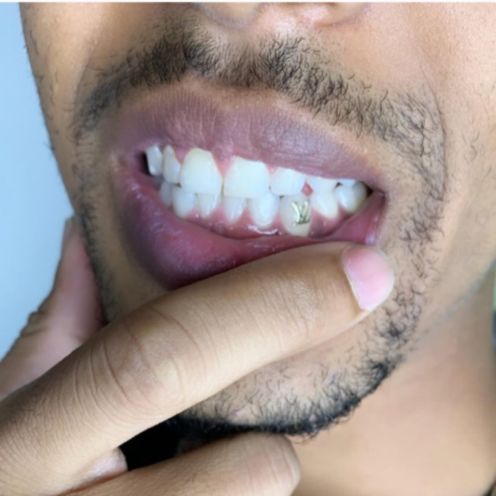 LV STO’NEᴺᴶ at MONMOUTH COUNTYᴺᴶ ✧ 1ST TOOTH JEWELER ↯ #POPURWAXINCHERRY in Hazlet, NJ