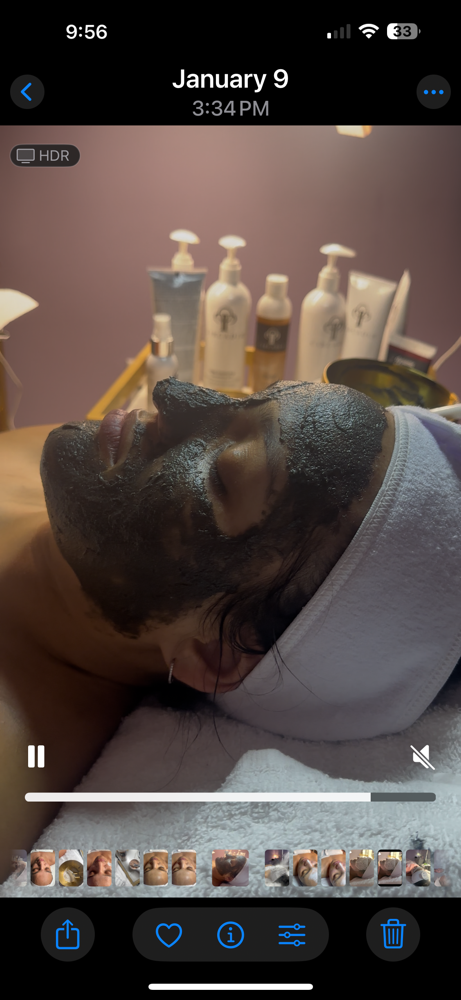 Acne Facial