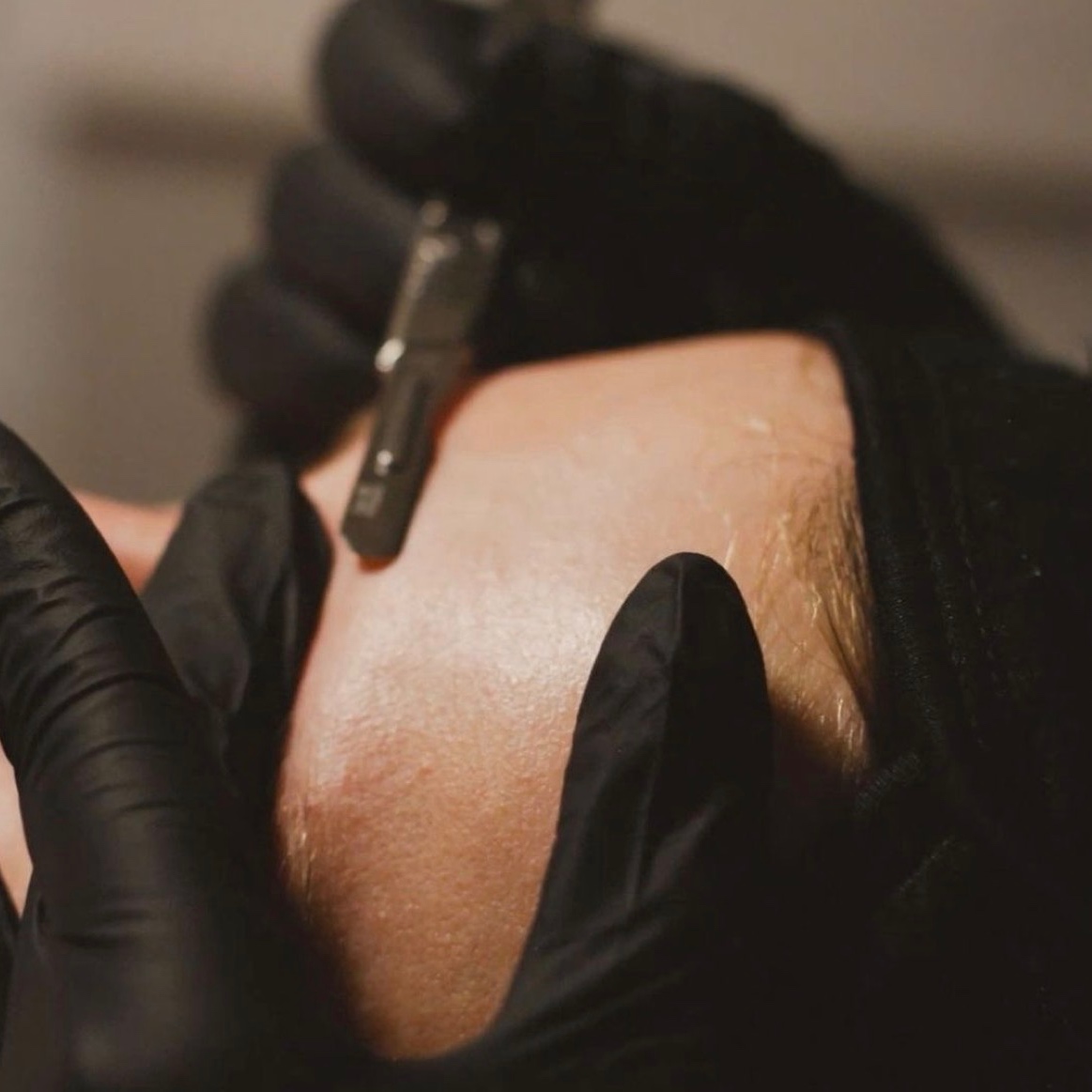Dermaplane at Bare + Bronzed in Fort Worth, TX