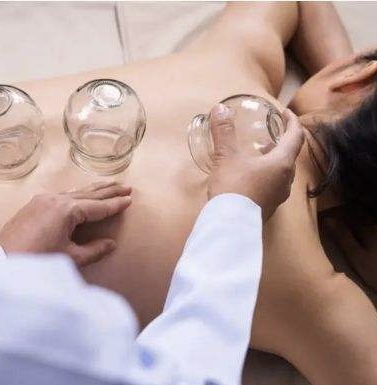 Cupping Body Treatment