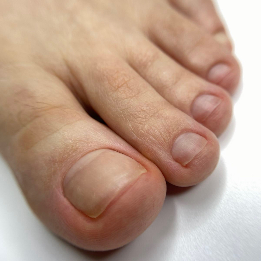 Pedicure No Polish at Shilo Studio Inc in Brooklyn, NY